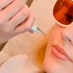 Laser Hair Removal Cardiff Wales