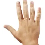 Wart treatments Cardiff, newport caerphilly south wales